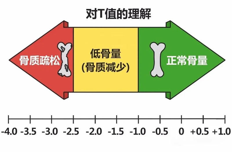 骨密度仪检测.jpg